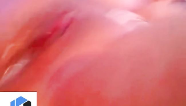 Free GF Melons Porn Videos: Amateur Big Boobs, Busty Teen Ex Girlfriend